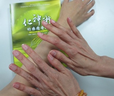 仁神術的療癒奇蹟